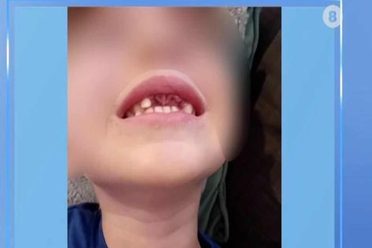 4-Year-Old’s Teeth Knocked Out at School: Bullying or Accident?